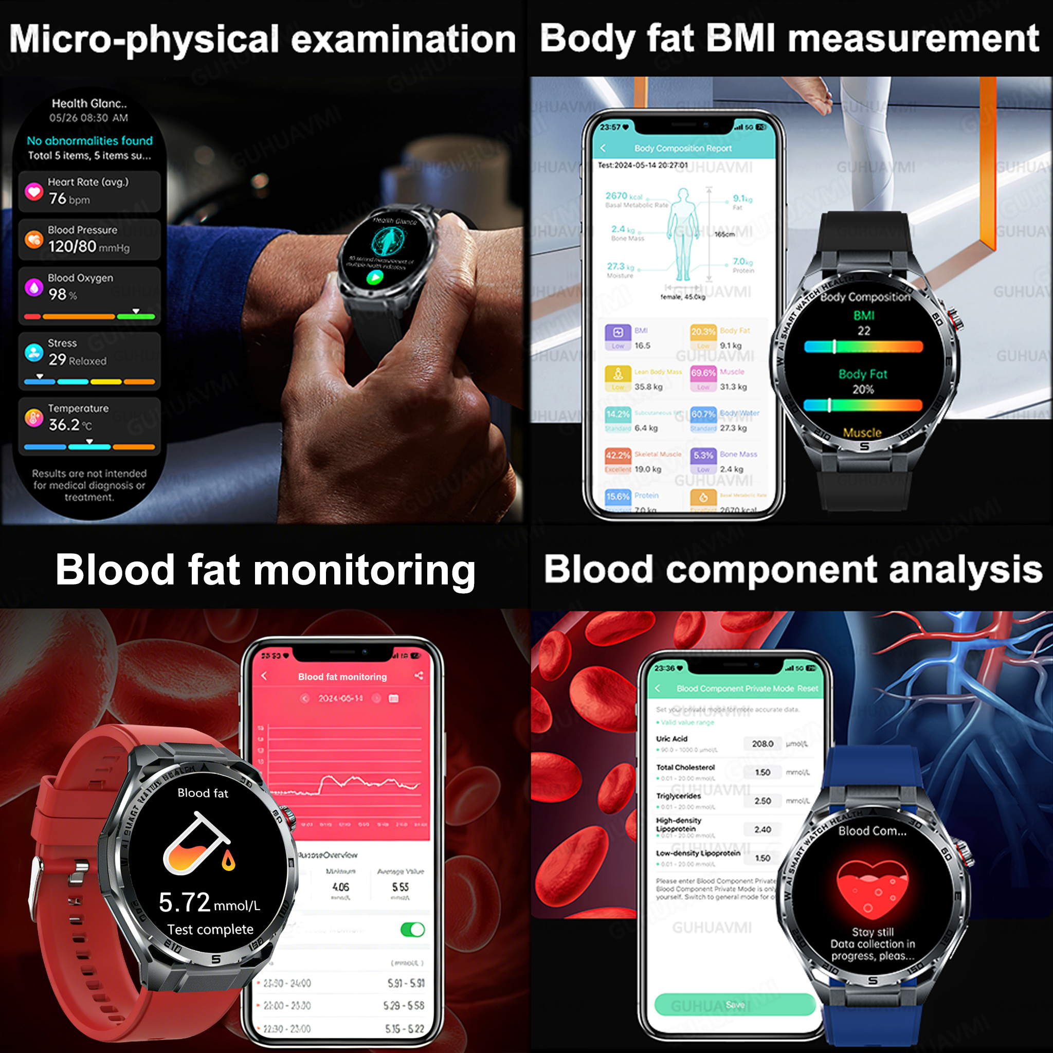 2026 New Body Fat AI Analysis  - Android Smartwatch Accessories review and price